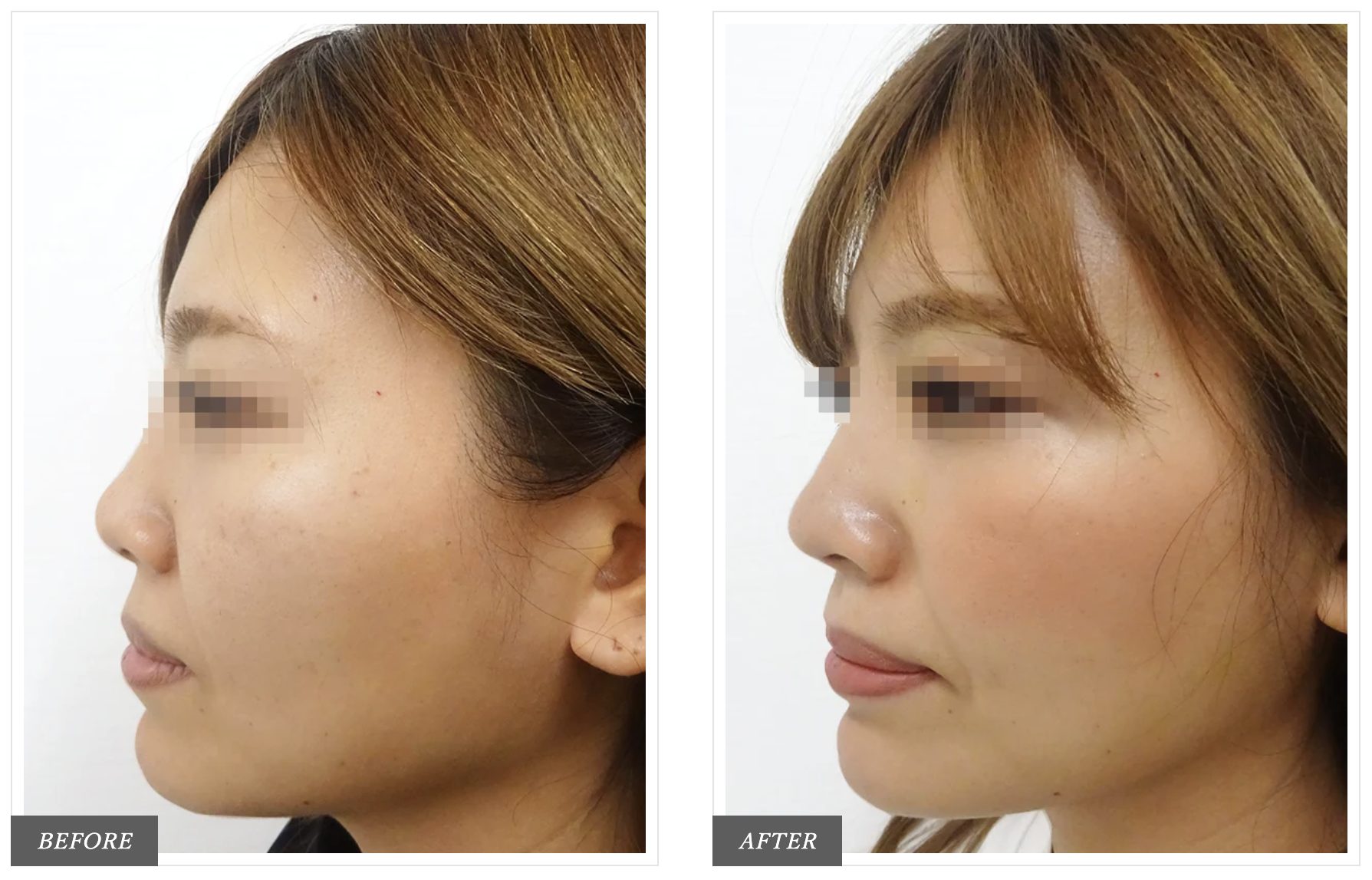 鼻プチ 小顔効果 プチ整形（XS S M）3サイズセット シリコン プレゼント プチ整形 鼻用アイプチ 美シルエット コスメ ファッション