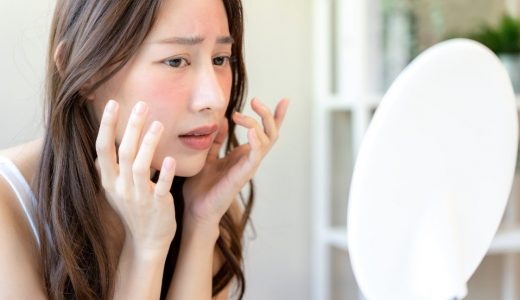 熊本のニキビ跡治療が安い・人気の美容皮膚科10選！人気の施術や料金をご紹介！