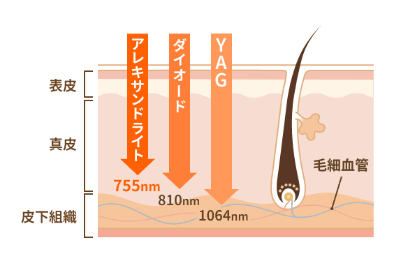 レーザーの種類と波長