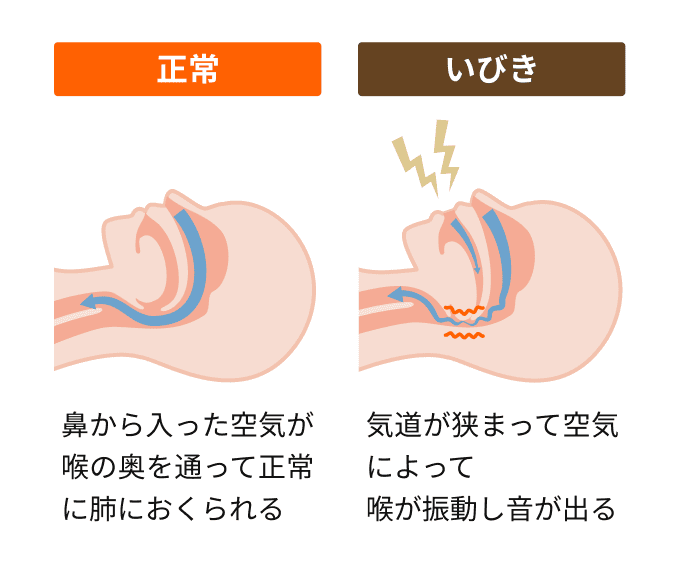 いびきの原因