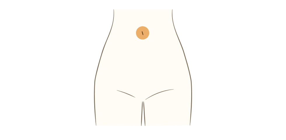 おへそ周り脱毛