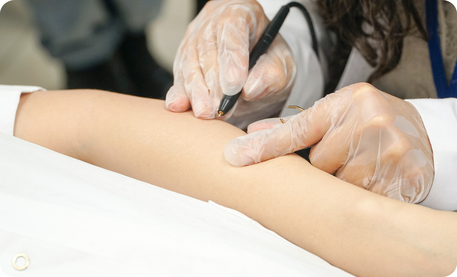 ニードル脱毛（医療針脱毛）とは？ 痛みについても解説